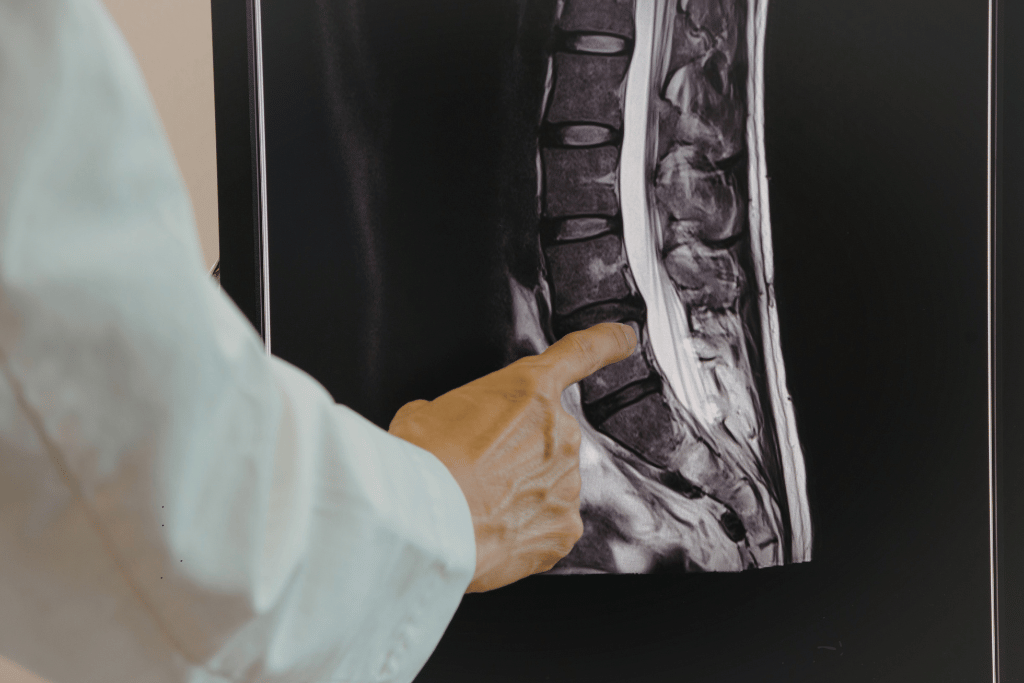 Spinal Injuries Impact Your Ability to Work